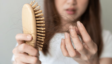 Rụng tóc ở nữ: nguyên nhân và cách khắc phục