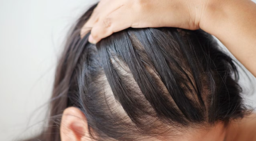 Tại sao gội đầu xong tóc vẫn bết?